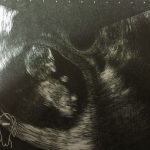 妊娠6ヵ月（23週）胎動をまだ感じない・少ない原因は？感じるコツは？